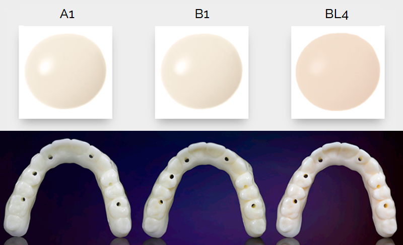 The results obtained with the KeyDenture Try-In resin